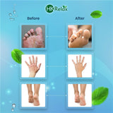 HK Skin Guard Herbal Malam, 30 gm